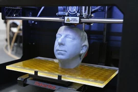 Tái tạo xương chậu bằng titan nhờ vào công nghệ in 3D