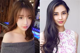 Khán giả Trung Quốc chỉ trích sao nữ phẫu thuật đến biến dạng