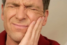 Bài thuốc trị đau răng hiệu quả