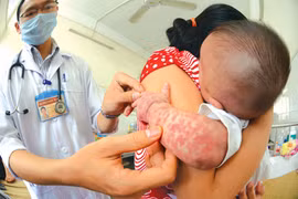 Những loại dịch bệnh dễ bùng phát năm 2015 tại Việt Nam