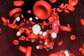 Thói quen hầu như ai cũng mắc gây chảy máu dạ dày