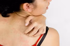 10 dấu hiệu ung thư dễ dàng bị bỏ qua 