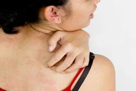 10 dấu hiệu ung thư dễ dàng bị bỏ qua 