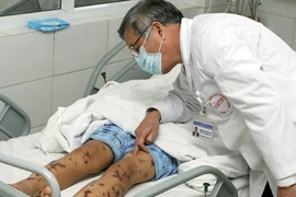 Hà Nội xuất hiện ca viêm màng não mô cầu đầu tiên