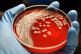 Thuốc mới tăng thời gian sống cho bệnh nhân ung thư vú