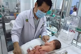 Cận cảnh khối u “thai ký sinh” trên người bệnh nhi