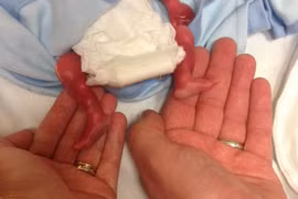 Rơi nước mắt trước bức ảnh vĩnh biệt đứa con chưa chào đời