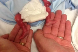 Rơi nước mắt trước bức ảnh vĩnh biệt đứa con chưa chào đời