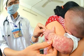 Giải đáp 18 thắc mắc về phòng chữa và vắc xin sởi 