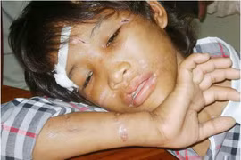 Xót lòng những em bé bị bạo hành như thời trung cổ