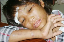 Xót lòng những em bé bị bạo hành như thời trung cổ