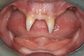 Những trường hợp mọc răng kỳ quặc nhất thế giới