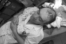 Tâm sự của bác sỹ từng bị người nhà bệnh nhân hành hung 