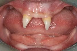 Điểm mặt những ca mọc răng "quái đản" nhất thế giới