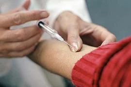 Bệnh lạ ở Quảng Nam làm chết người là bệnh bạch hầu