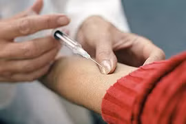 Bệnh lạ ở Quảng Nam làm chết người là bệnh bạch hầu