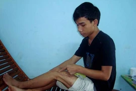 Những vụ bác sĩ quên, nhầm khó tin ở Việt Nam