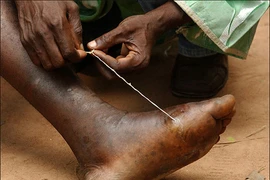 Sởn gai ốc trước những động vật ký sinh đáng sợ nhất 