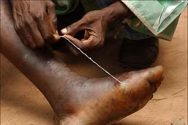 Sởn gai ốc trước những động vật ký sinh đáng sợ nhất 