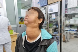 U lớn tuyến giáp kết hợp u máu đẩy khí quản và thực quản sang phải