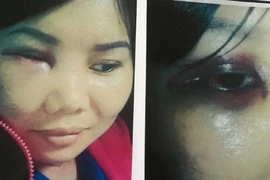 Vụ ghen ngược vẫn chưa có hồi kết