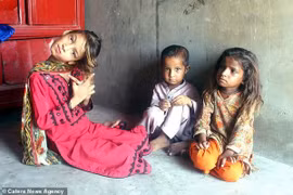 Bé gái sống với chiếc cổ vẹo 90 độ vì nguyên nhân bất ngờ