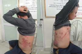 Hà Nội: Nghi vấn phản đối thu phí BOT, tài xế bị đánh gãy xương sườn?