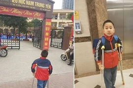 Thông tin mới vụ học sinh tiểu học Nam Trung Yên gãy chân trong trường