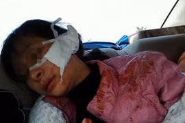 Video: Toàn cảnh hiện trường nữ sinh lớp 11 bị rạch mặt dã man