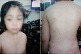 Hà Nội: Nghi vấn bé 10 tuổi bị bố, mẹ kế bạo hành dã man
