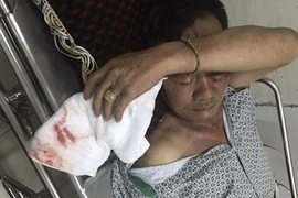 ​Nguyên nhân ban đầu khiến người cựu chiến binh bị đánh ở Hà Nội