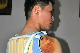 Bênh cha, "quý tử" của bí thư xã bắn người trọng thương