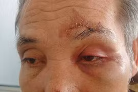 Đánh người nhập viện vì nợ 190 nghìn đồng ở Hà Nội