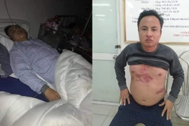 Tài xế phản đối BOT tiết lộ nguyên nhân bị đánh gãy xương sườn