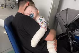 Con trai bị bỏng ở trường mẫu giáo, cha mẹ phẫn nộ vì cách xử lý của nhà trường khiến con càng thêm nặng