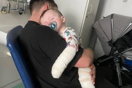 Con trai bị bỏng ở trường mẫu giáo, cha mẹ phẫn nộ vì cách xử lý của nhà trường khiến con càng thêm nặng