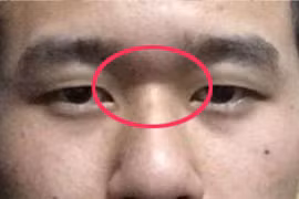 Người có bốn tướng mạo này cả đời sẽ nghèo khó