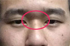 Người có bốn tướng mạo này cả đời sẽ nghèo khó