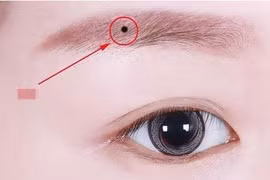 Người có 4 nốt ruồi này vừa giàu vừa sang, cả đời phú quý