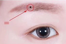 Người có 4 nốt ruồi này vừa giàu vừa sang, cả đời phú quý