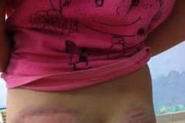 Bé gái lớp 4 bị thầy giáo bạo hành vì…không thuộc bài?