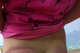 Bé gái lớp 4 bị thầy giáo bạo hành vì…không thuộc bài?