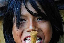 “Rùng mình” màn xuyên xương khỉ qua môi...làm đẹp