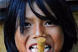 “Rùng mình” màn xuyên xương khỉ qua môi...làm đẹp