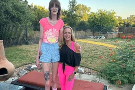 Chia sẻ của cô gái có đôi chân dài nhất thế giới