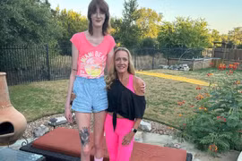 Chia sẻ của cô gái có đôi chân dài nhất thế giới