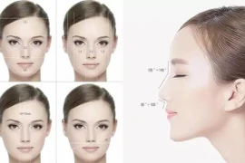 Phẫu thuật thẩm mỹ: Cẩn thận phá tướng, mất hết phúc lộc