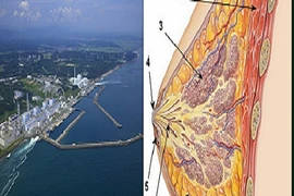 Phóng xạ tại Nhật tăng khả năng gây ung thư vú