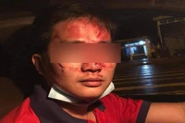 Lời kể của tài xế taxi bị khách đấm túi bụi trên xe 