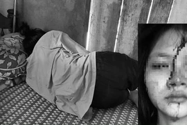 Nữ sinh Huế bị bạn học cùng trường đánh chấn động não 